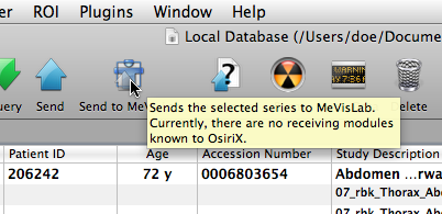 OsiriX could not detect any OsiriXBridge modules