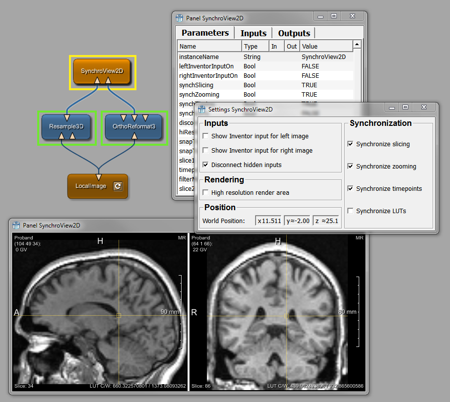 Example Network for SynchroView2D with Viewer (Panel), Automatic Panel, and Settings