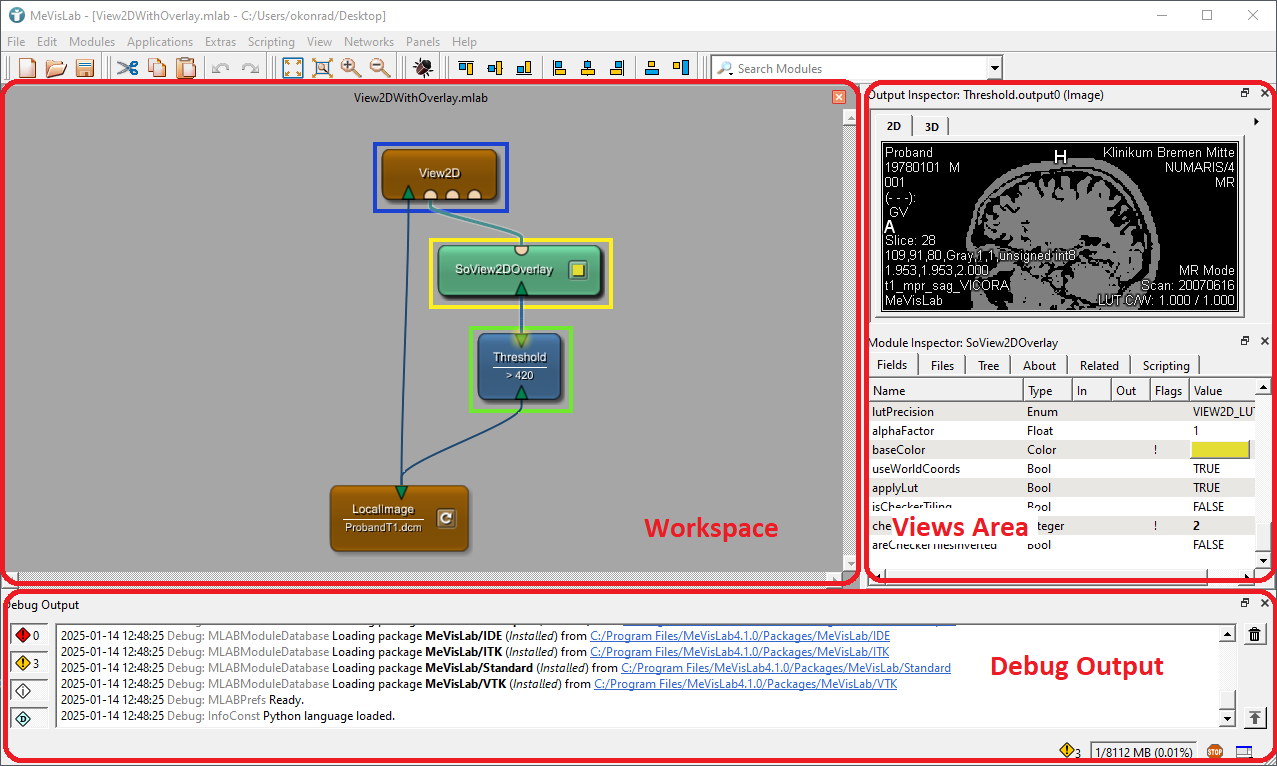Typical MeVisLab User Interface
