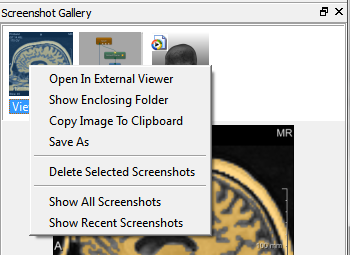 Screenshot Gallery Context Menu